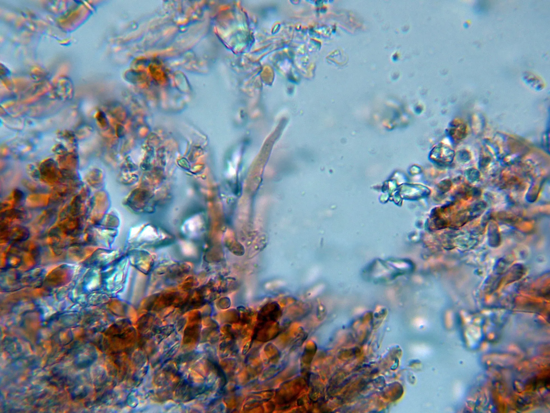 Microscopía de Phlebia subserialis - 10 - Cistidio-003